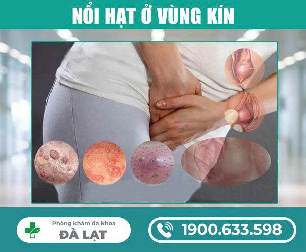 Hình ảnh minh họa